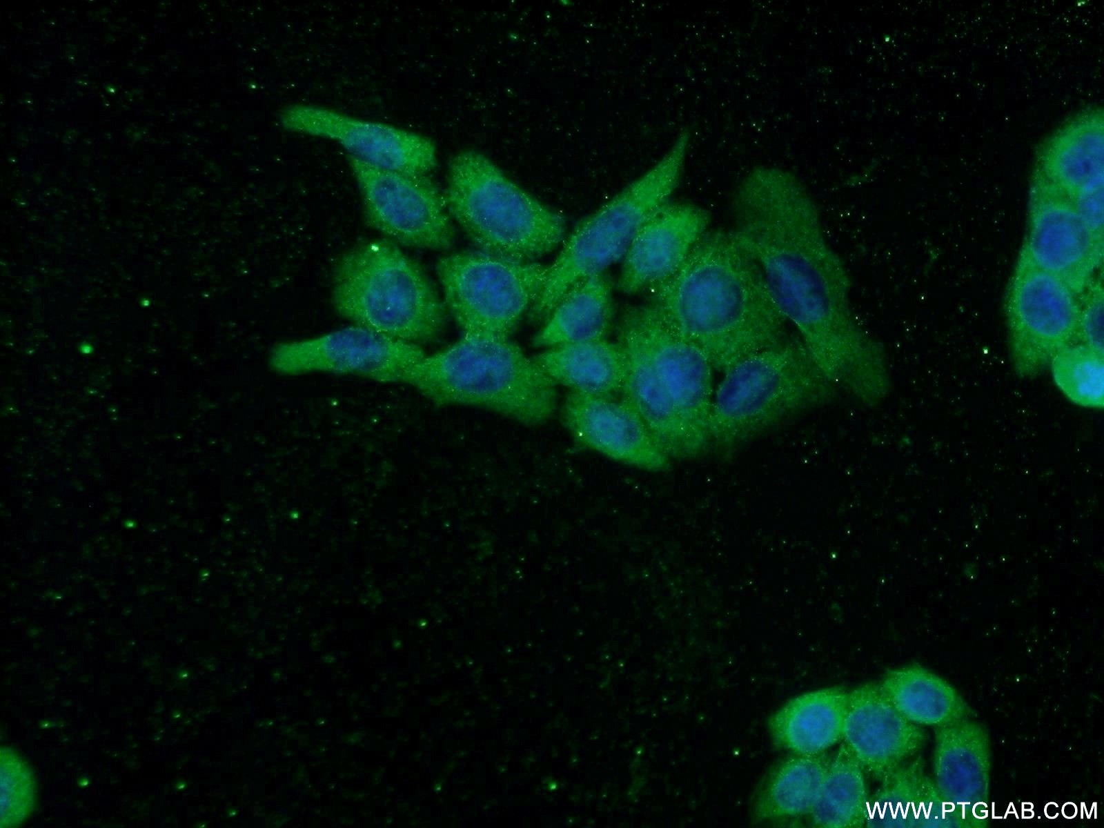 IF Staining of HeLa using 16739-1-AP