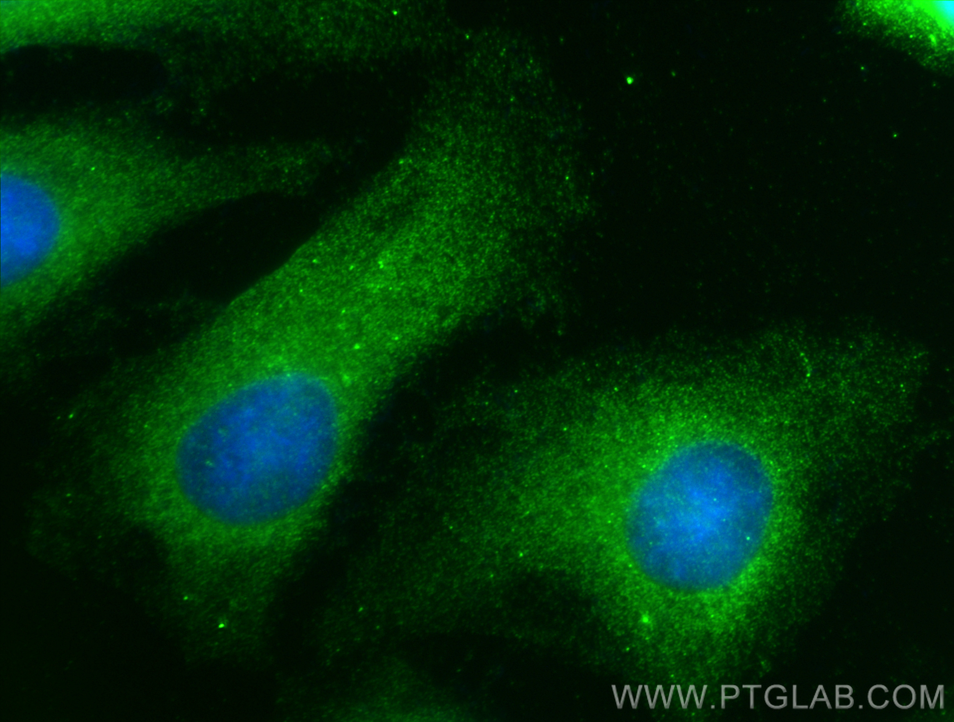 IF Staining of HeLa using 14424-1-AP