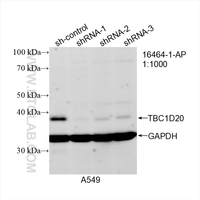 WB analysis of A549 using 16464-1-AP