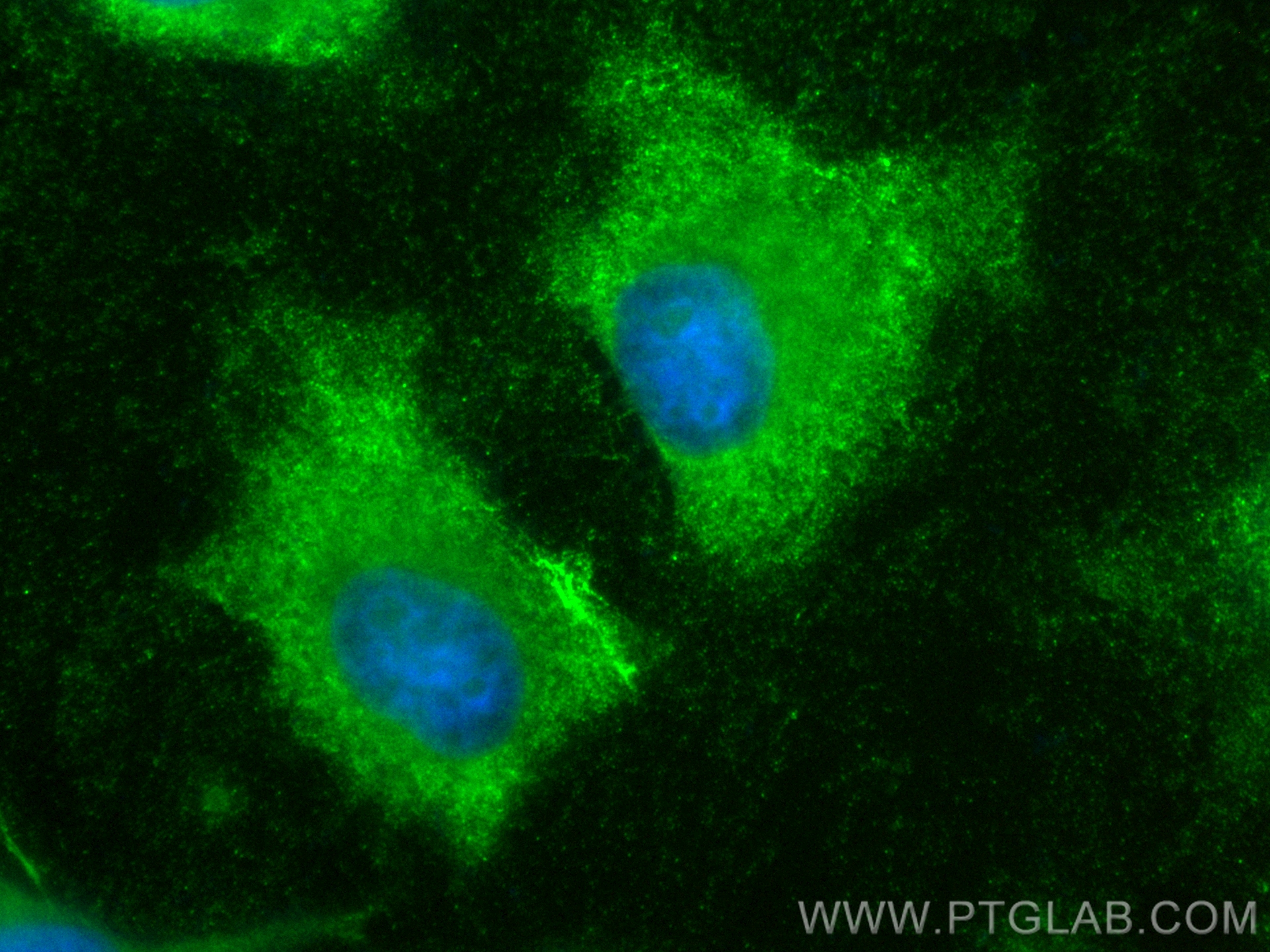 IF Staining of HeLa using CL488-15782