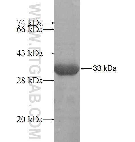 TBCB fusion protein Ag8616 SDS-PAGE