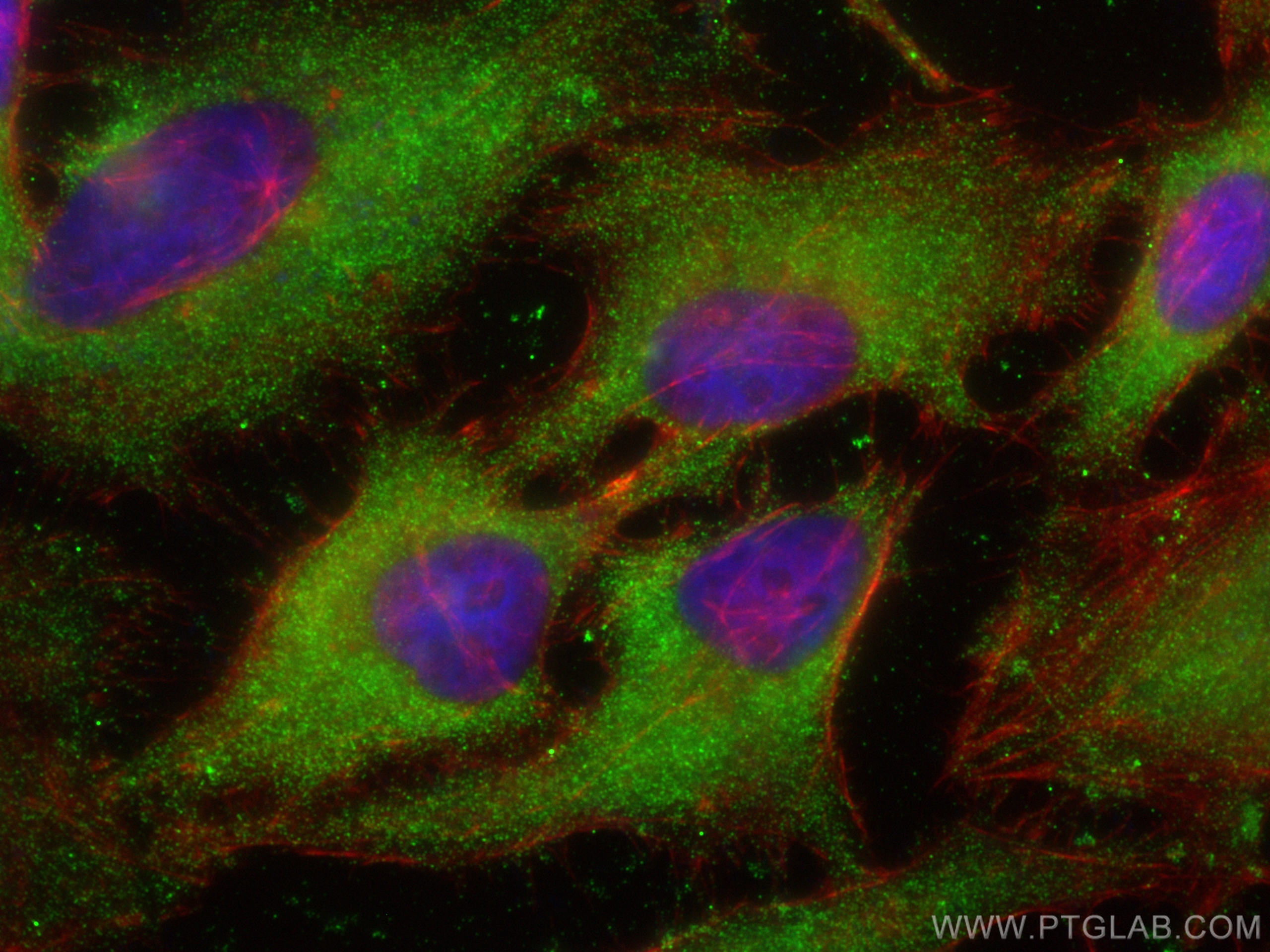 IF Staining of HeLa using 68371-1-Ig (same clone as 68371-1-PBS)