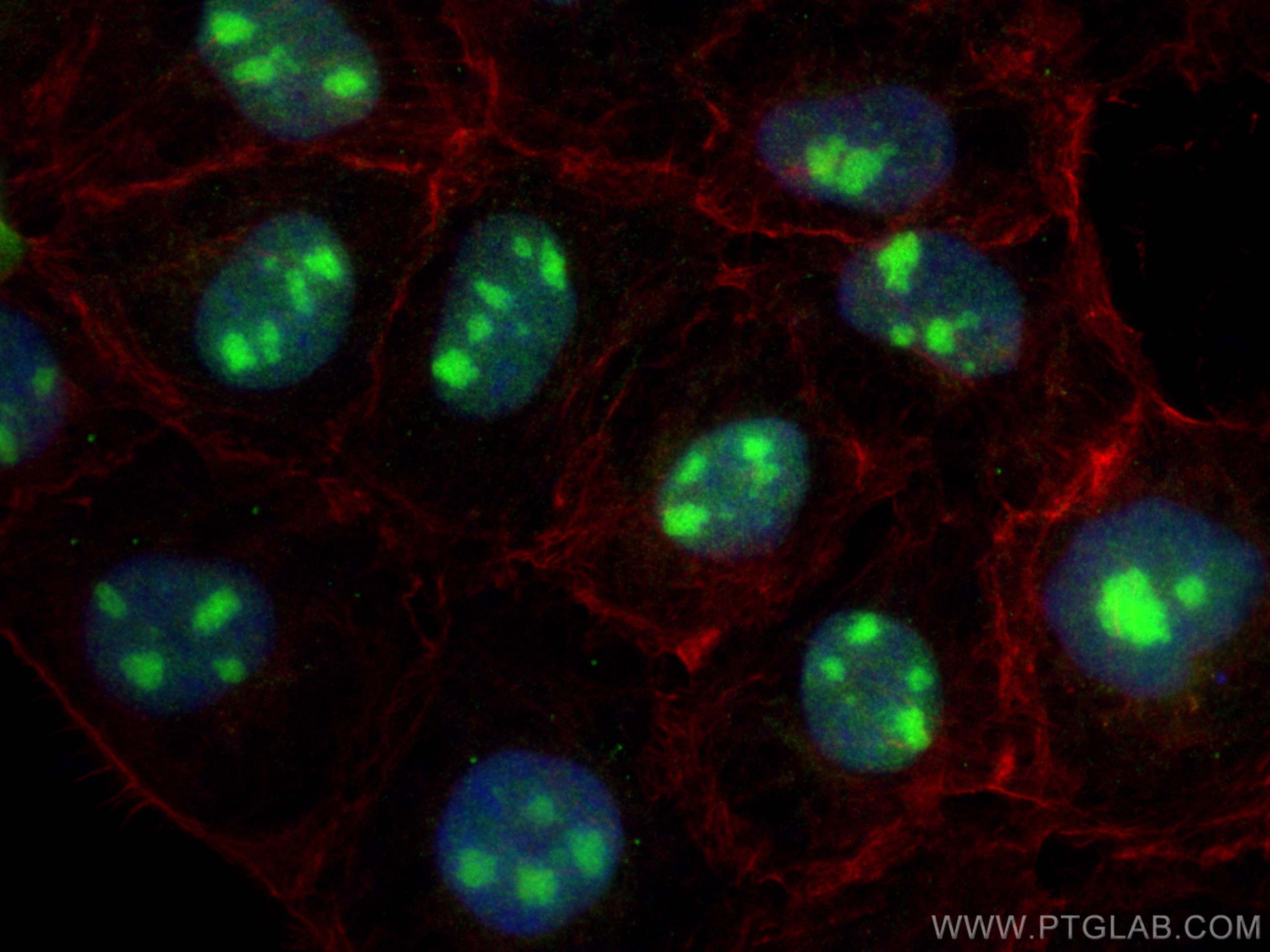 IF Staining of A431 using 31150-1-AP (same clone as 31150-1-PBS)