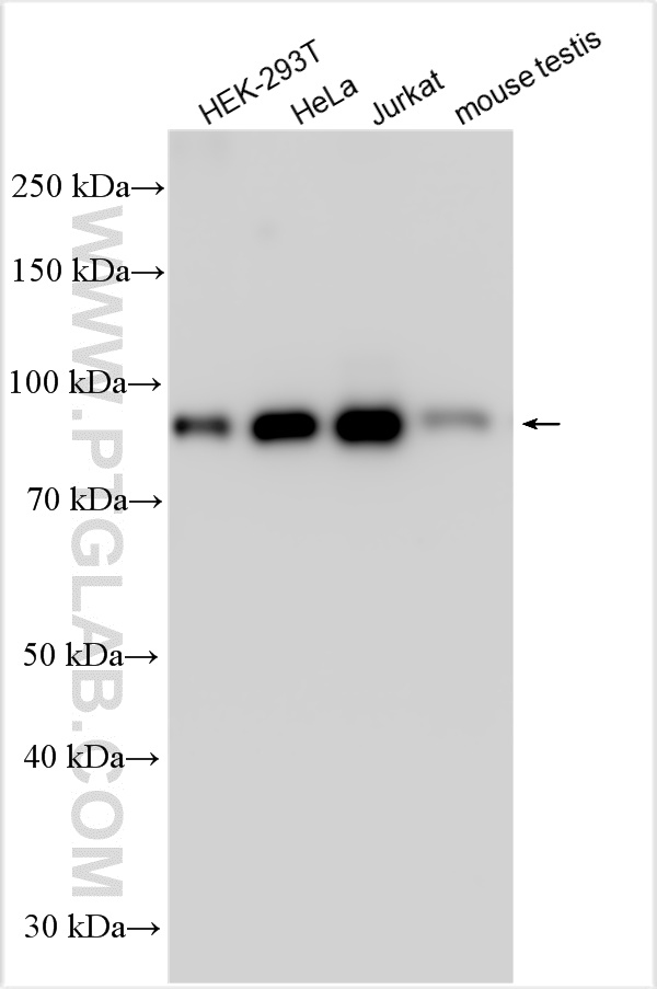 WB analysis using 31150-1-AP (same clone as 31150-1-PBS)