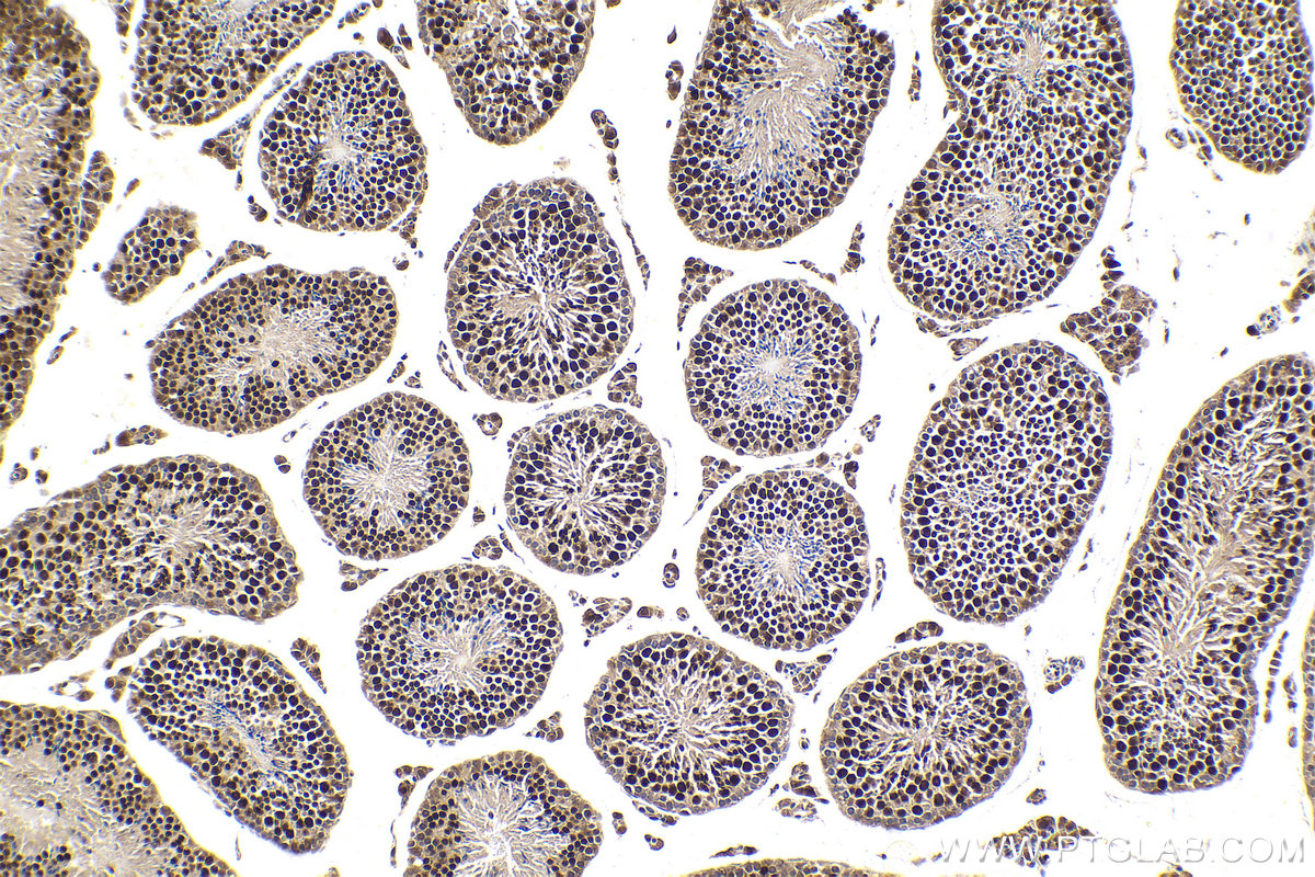 IHC staining of mouse testis using 12258-1-AP