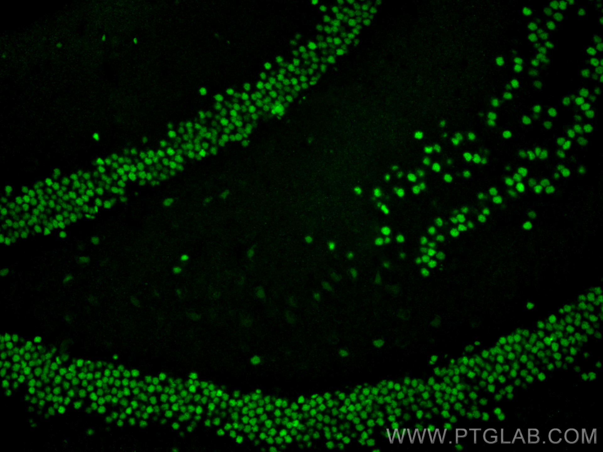 IF Staining of mouse brain using 20932-1-AP