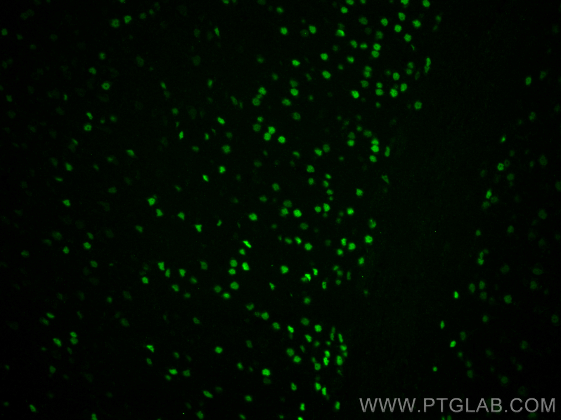 IF Staining of mouse brain using 66564-1-Ig