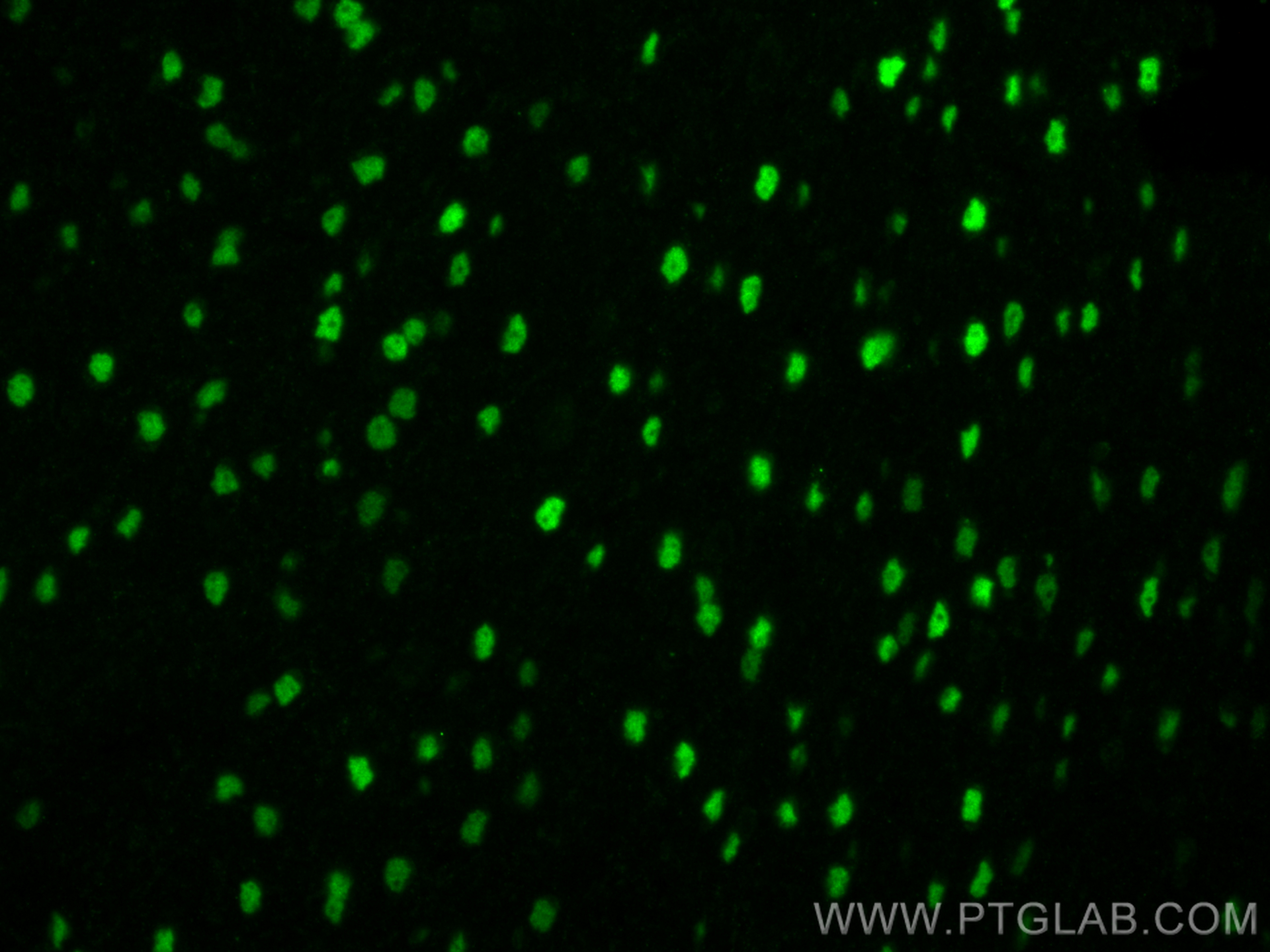 IF Staining of mouse brain using 66564-1-Ig