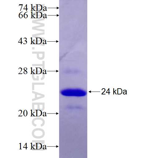 TBRG1 fusion protein Ag27507 SDS-PAGE