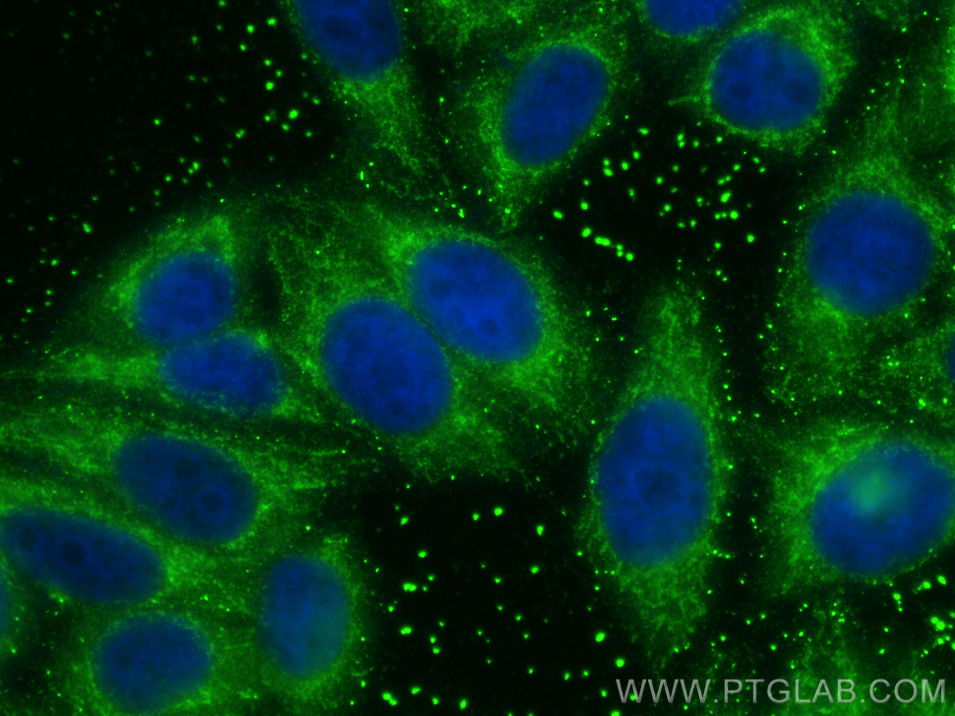 IF Staining of HepG2 using 10177-2-AP