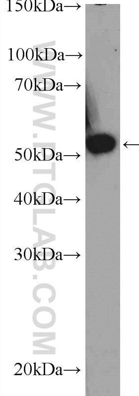 WB analysis of A431 using 10177-2-AP