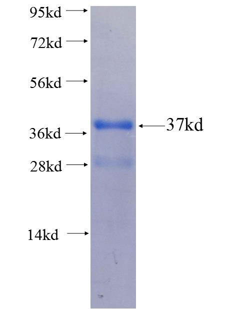 TBX1 fusion protein Ag26685 SDS-PAGE