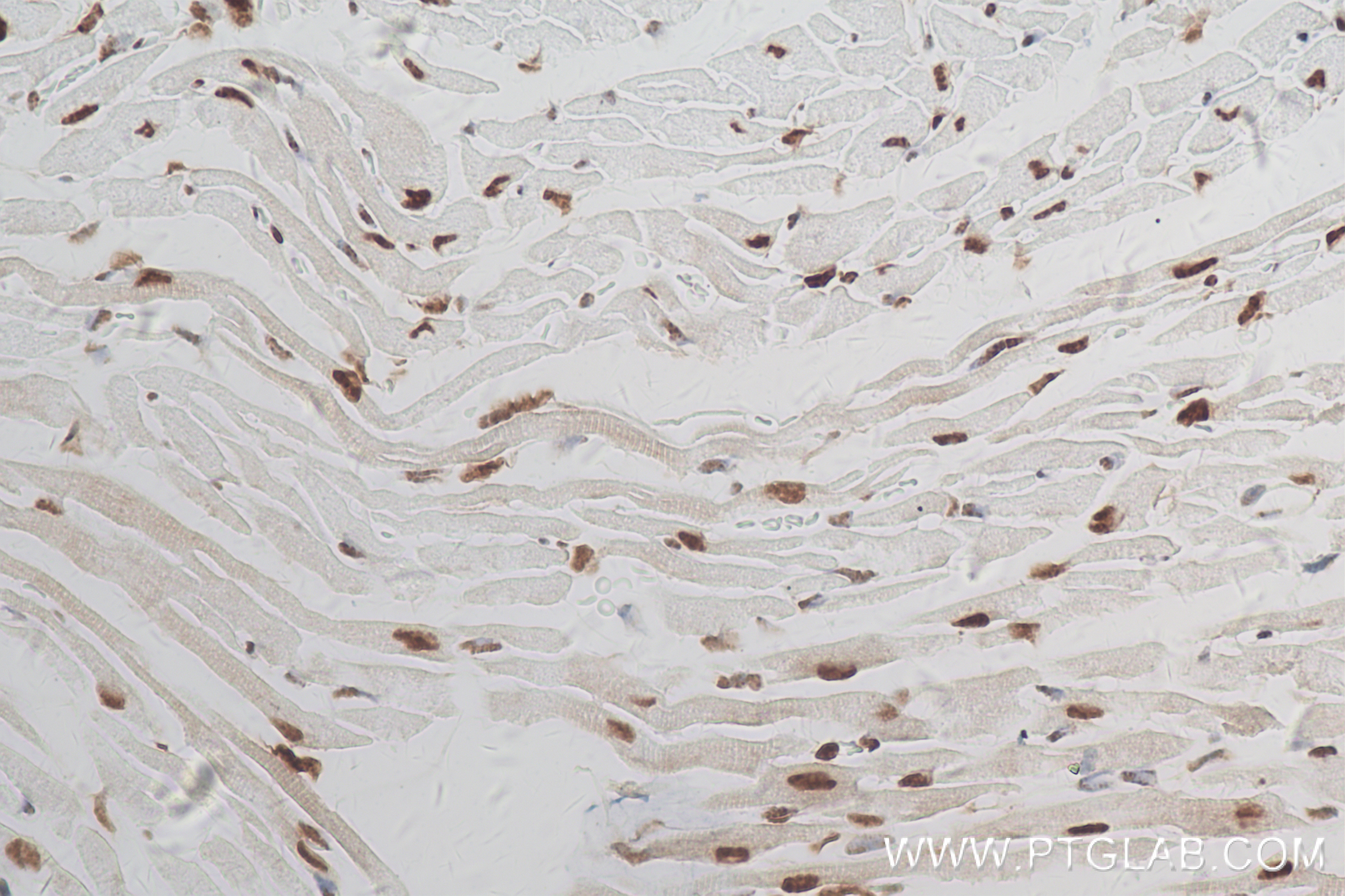 IHC staining of mouse heart using 83414-3-RR