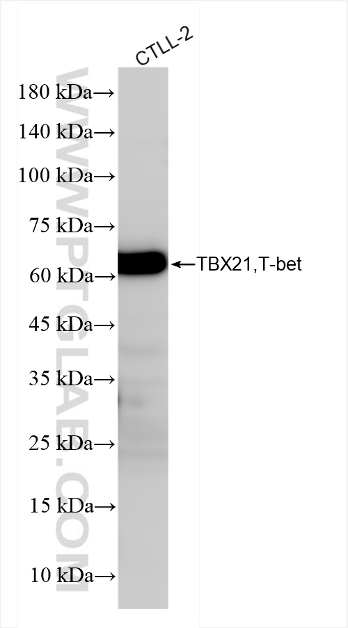 TBX21,T-bet