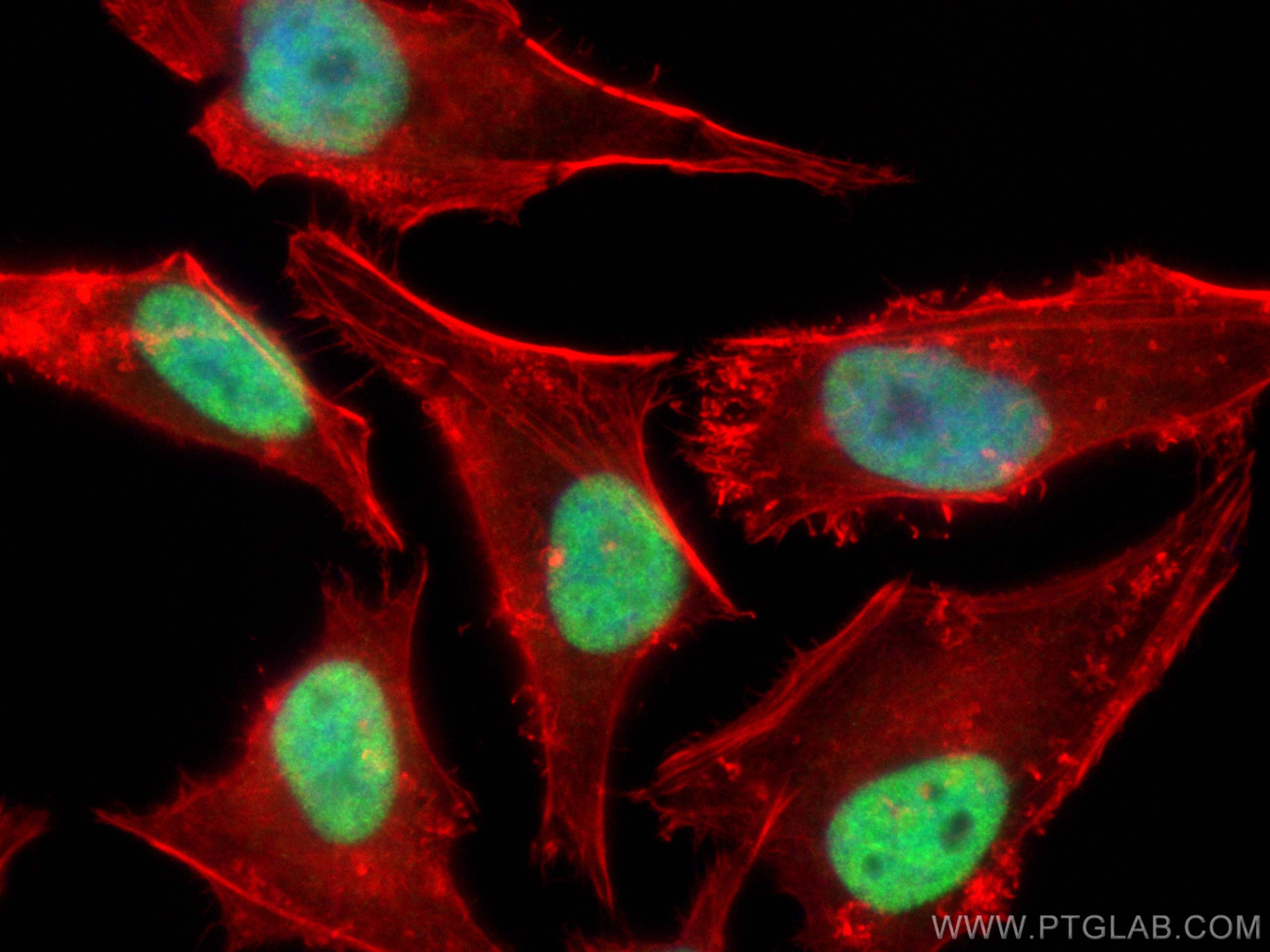 IF Staining of HeLa using 10502-1-AP