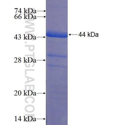 TCF19 fusion protein Ag5822 SDS-PAGE