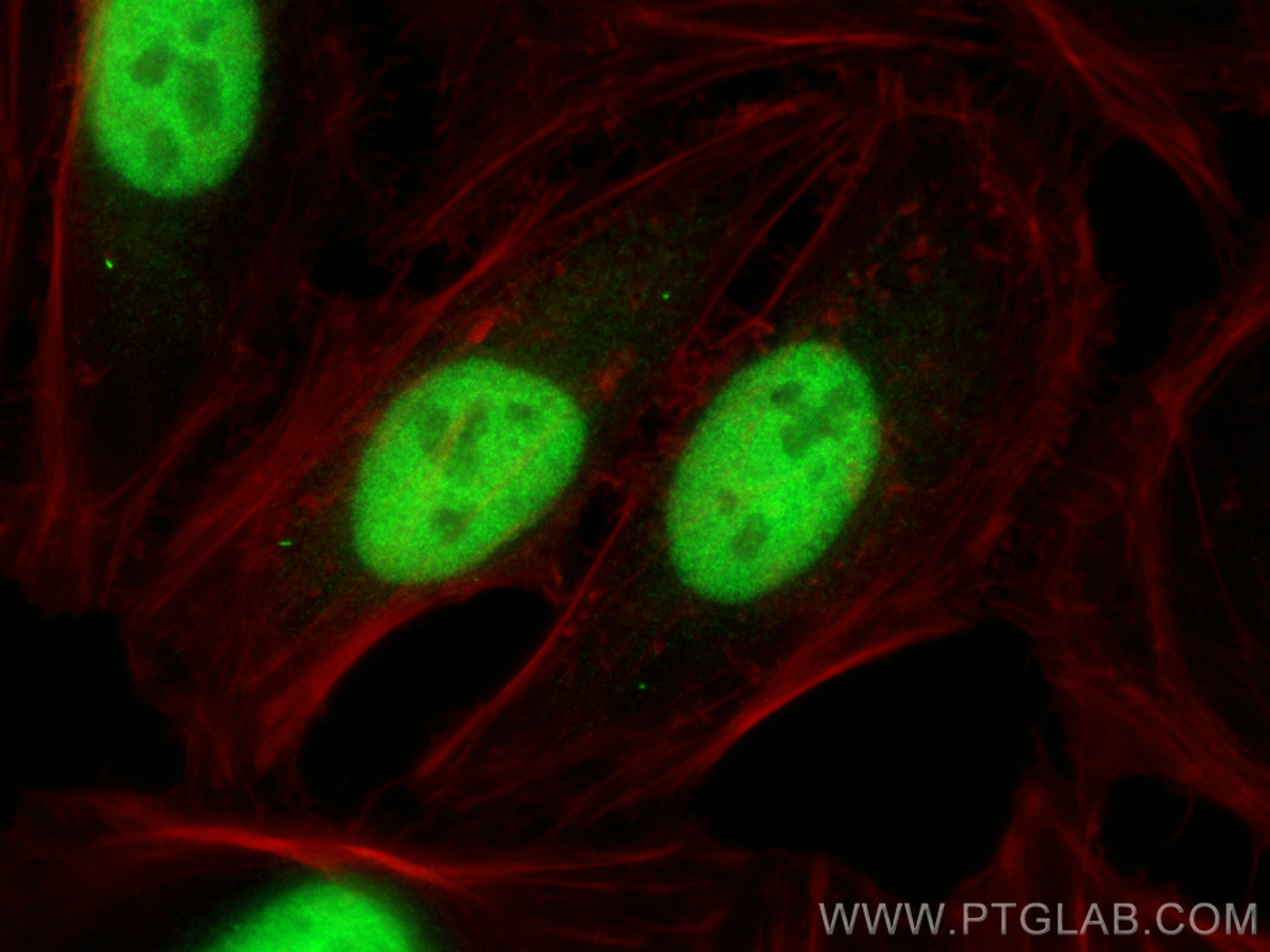 IF Staining of HeLa using 21242-1-AP