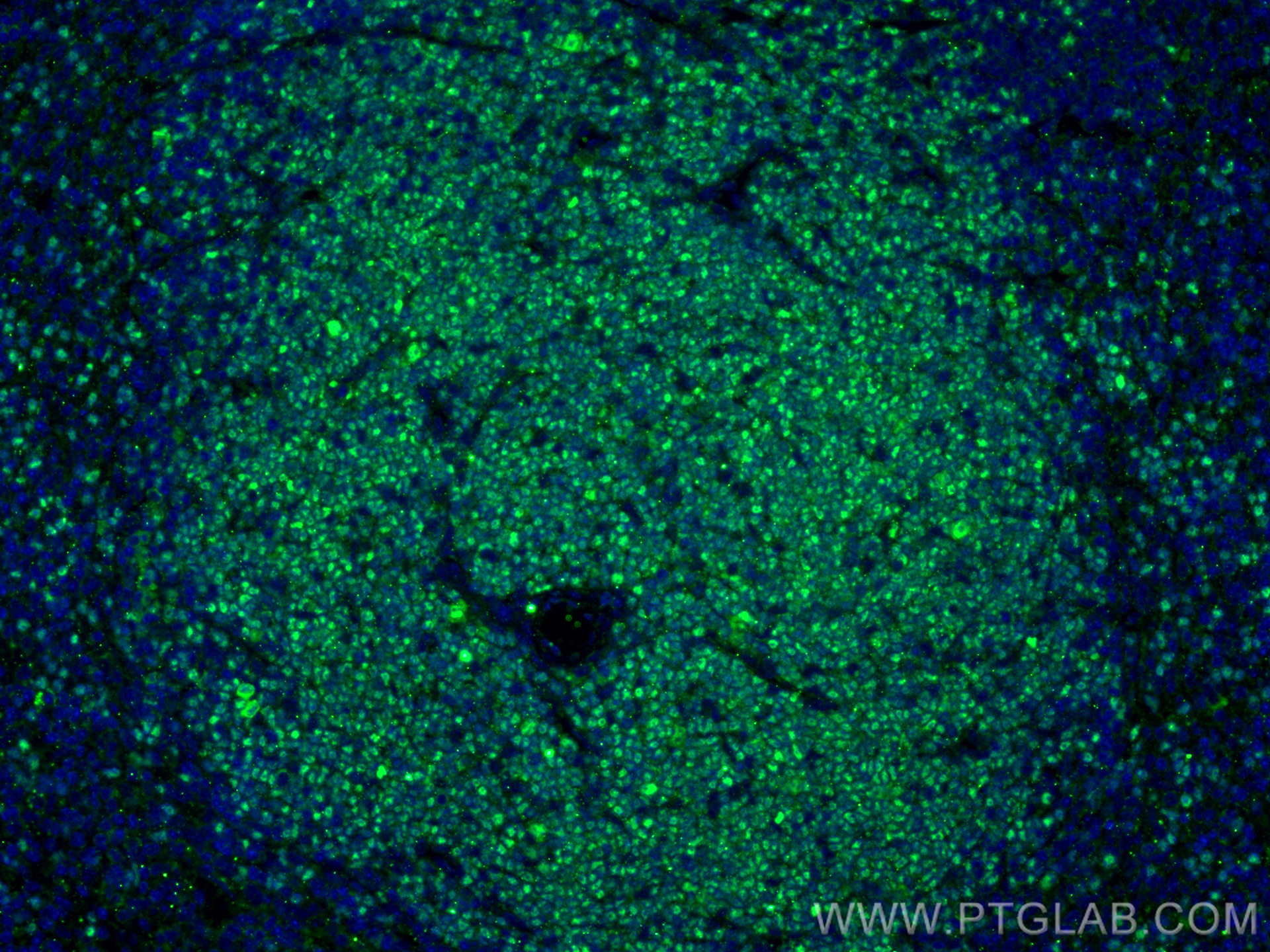 IF Staining of mouse spleen using 14464-1-AP