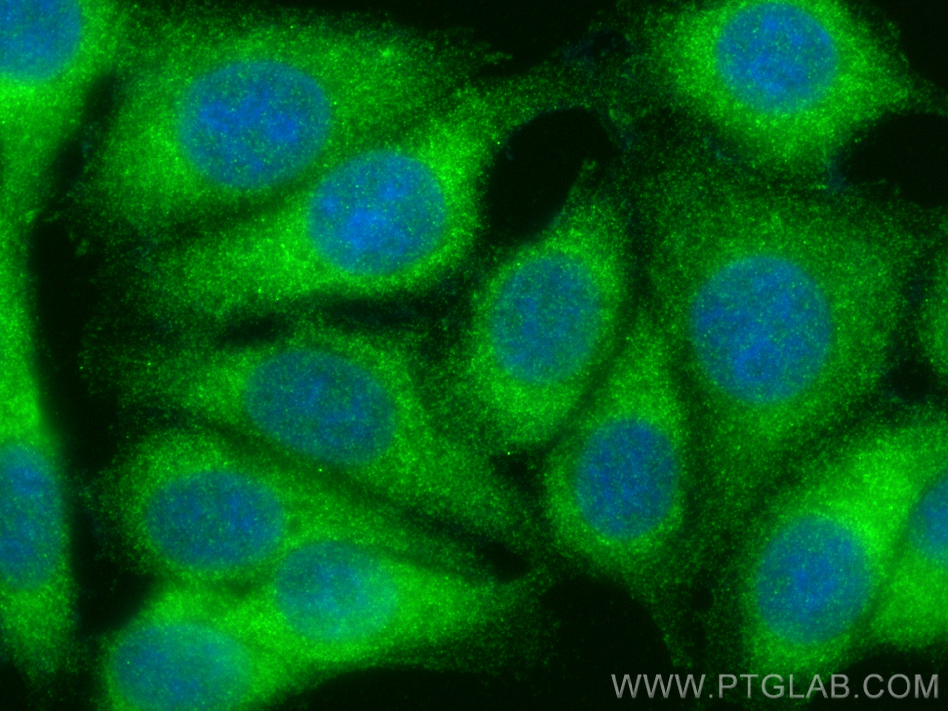 IF Staining of MCF-7 using 25931-1-AP