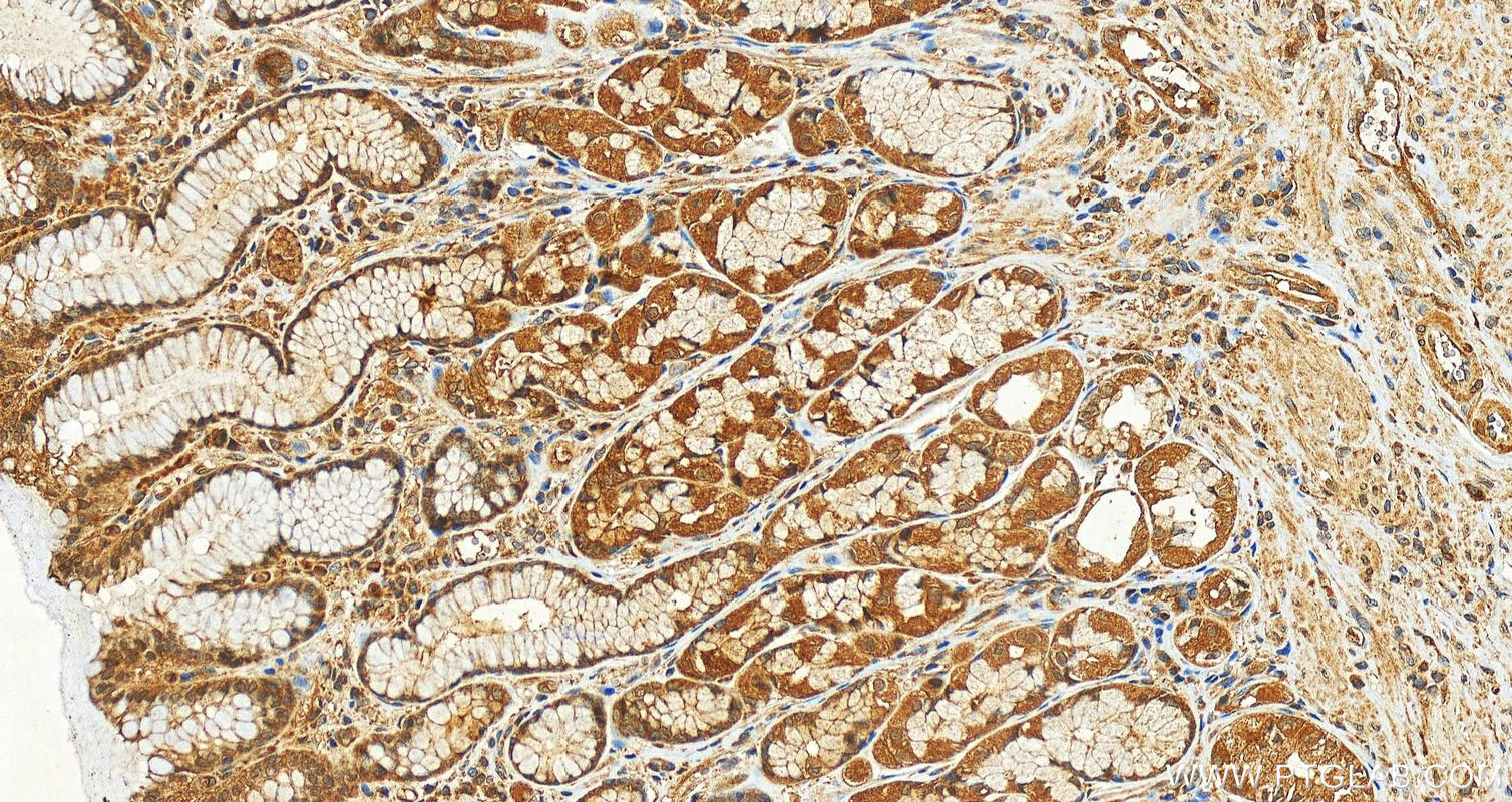 IHC staining of human stomach using 12649-1-AP