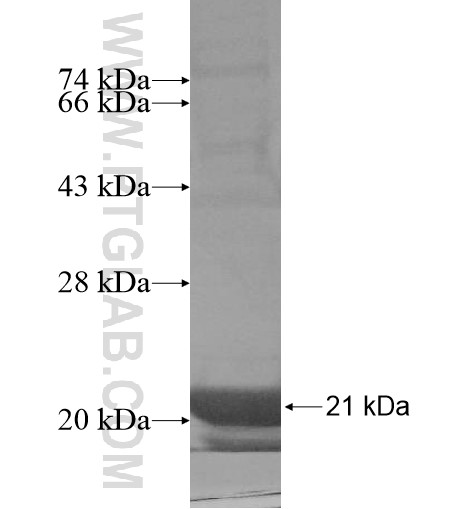 TCL1B fusion protein Ag10367 SDS-PAGE