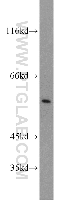 WB analysis of MCF-7 using 10320-1-AP