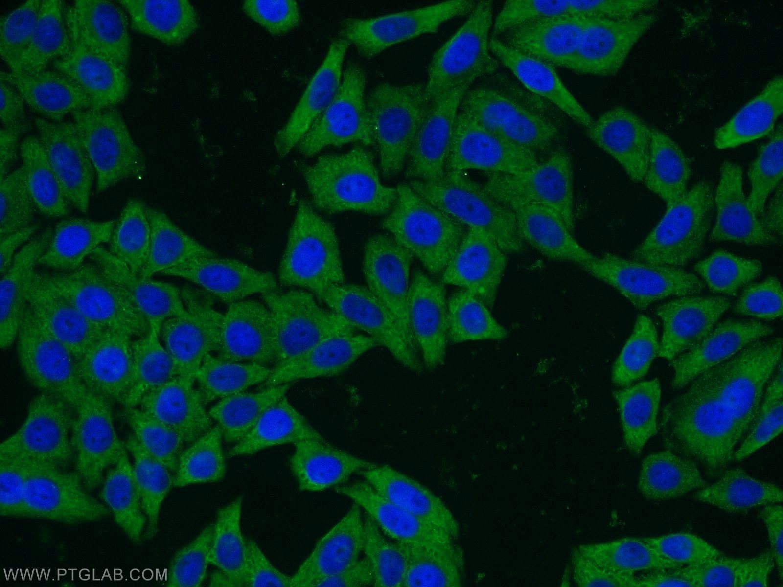 IF Staining of HepG2 using 14538-1-AP