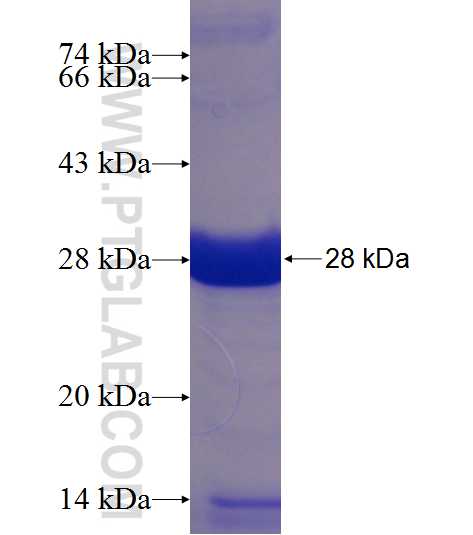 TCTEX1D4 fusion protein Ag23655 SDS-PAGE