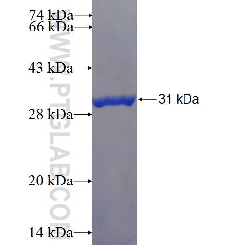 TCTEX1D4 fusion protein Ag24609 SDS-PAGE