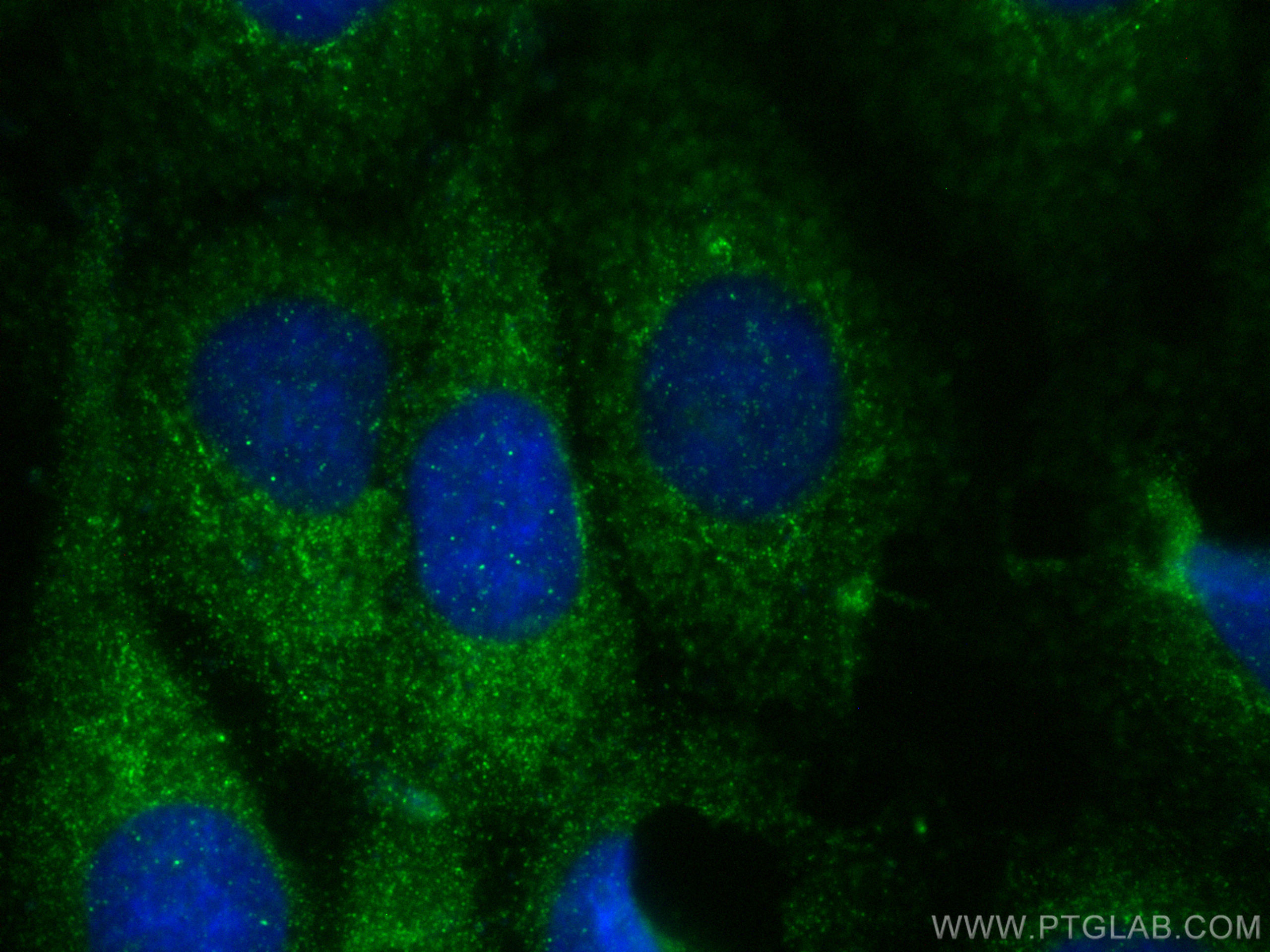 IF Staining of A431 using 15880-1-AP