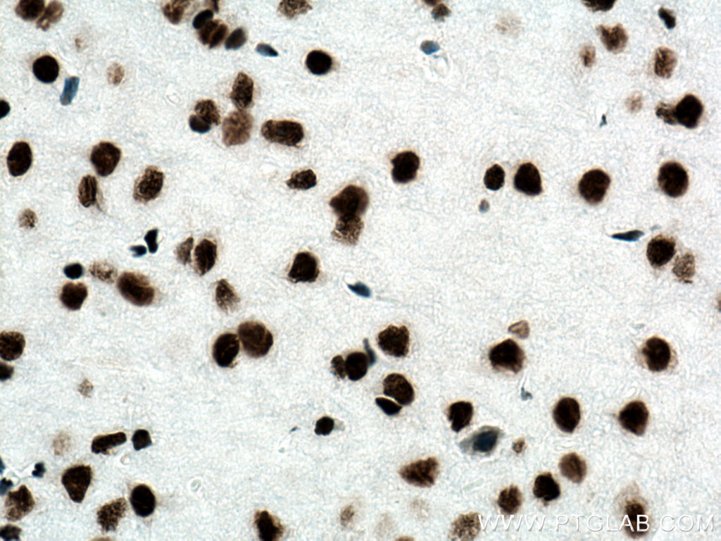 IHC staining of mouse brain using 80002-1-RR (same clone as 80002-1-PBS)