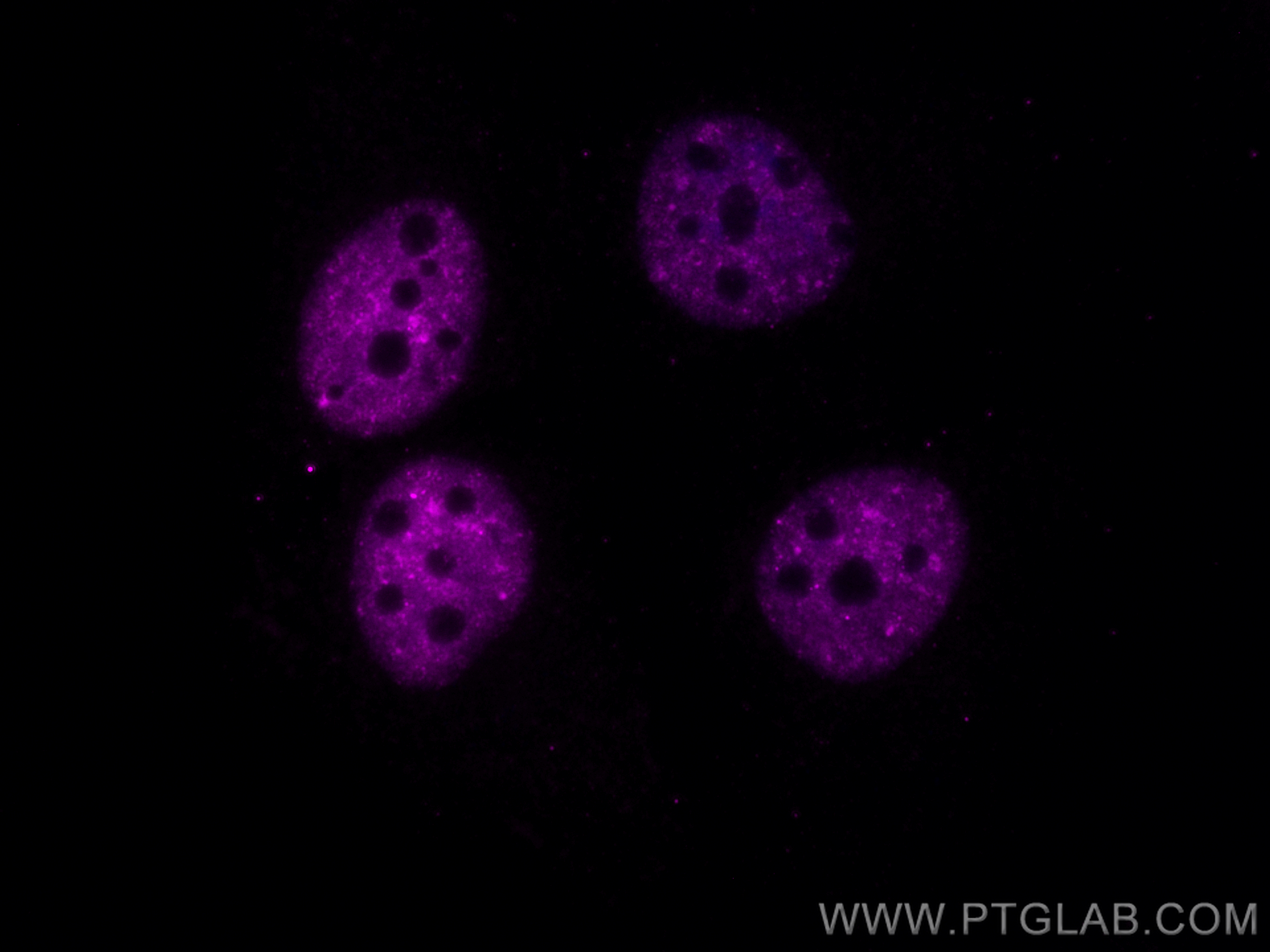 IF Staining of HeLa using CL647-67345