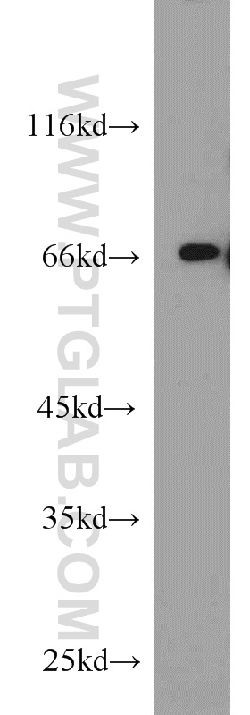 WB analysis of MCF-7 using 10641-1-AP