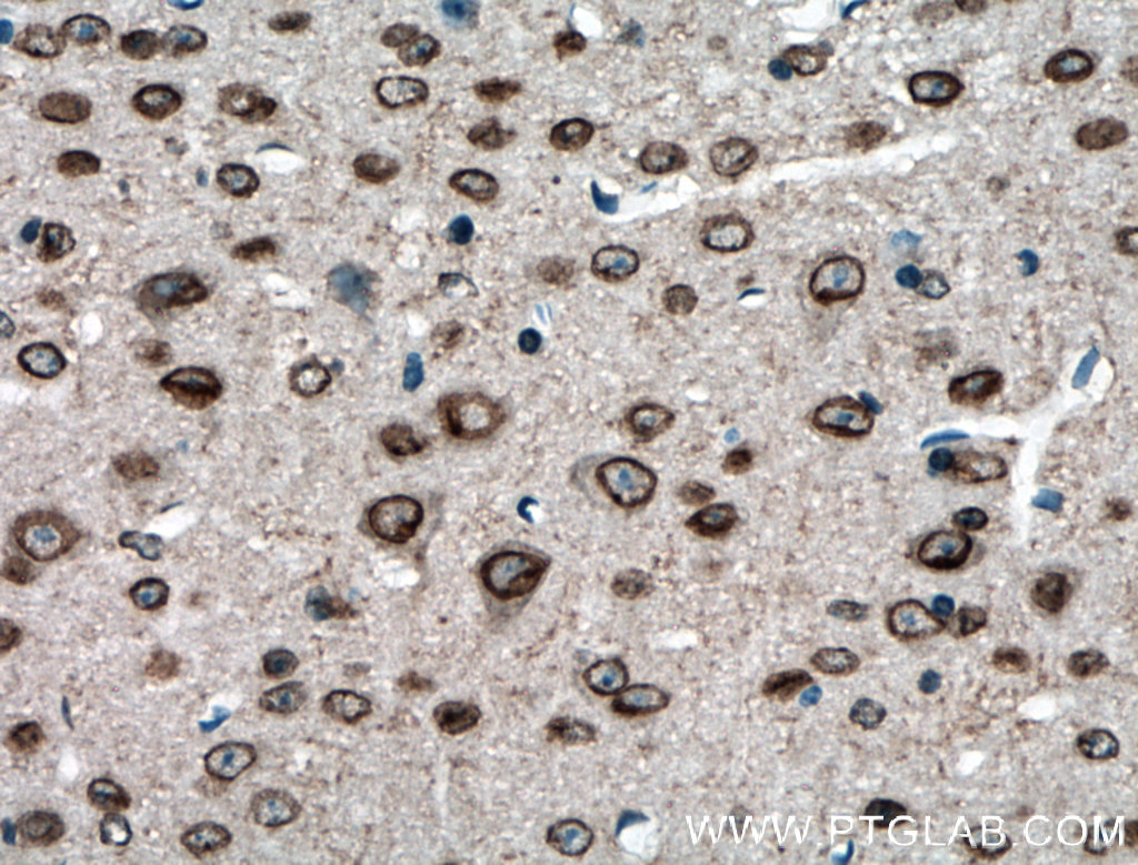 IHC staining of mouse brain using 13359-1-AP