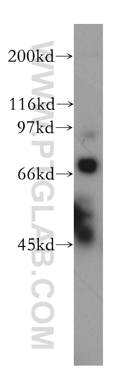 WB analysis of HEK-293 using 13359-1-AP