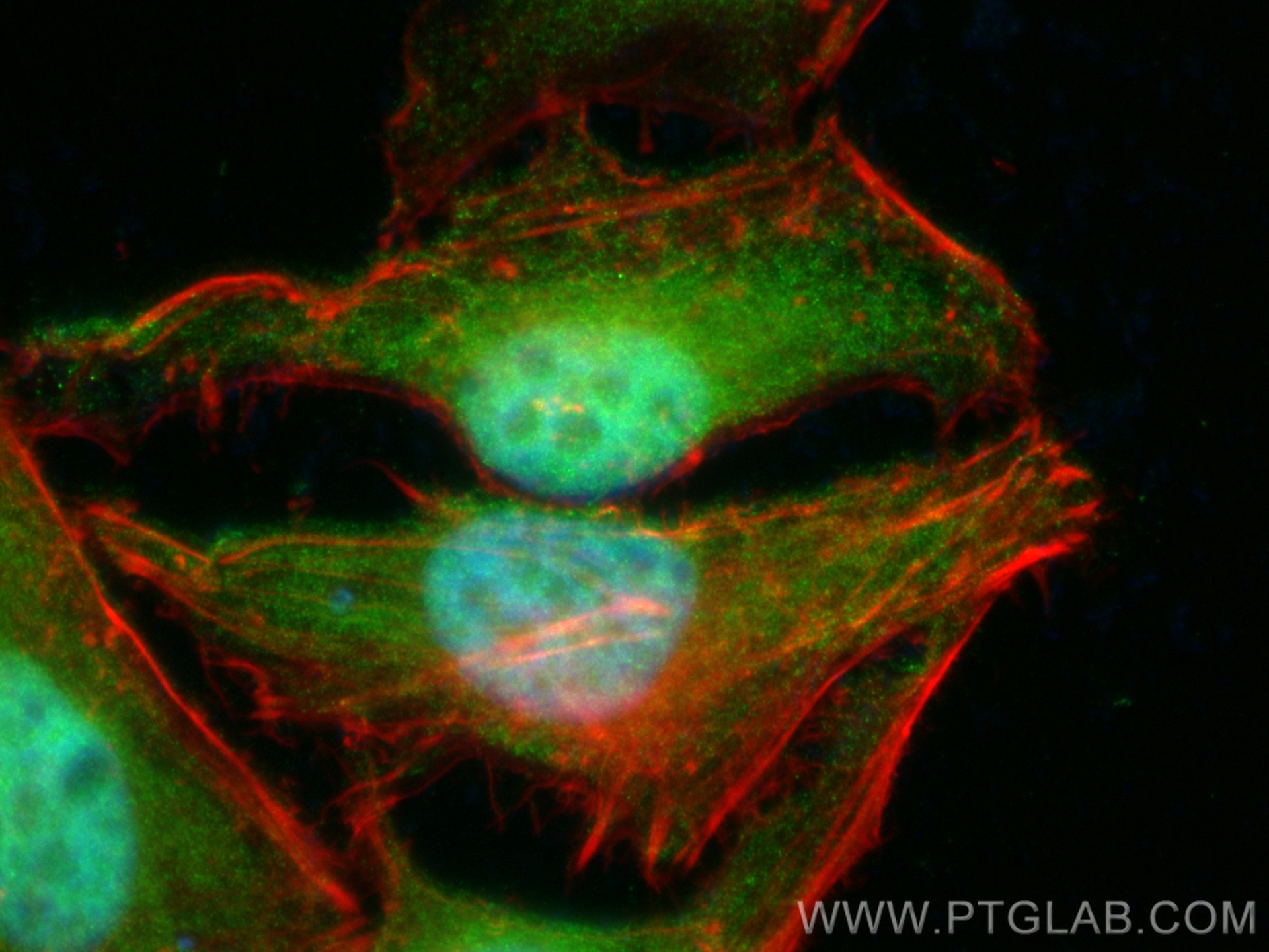 IF Staining of HeLa using CL488-13359