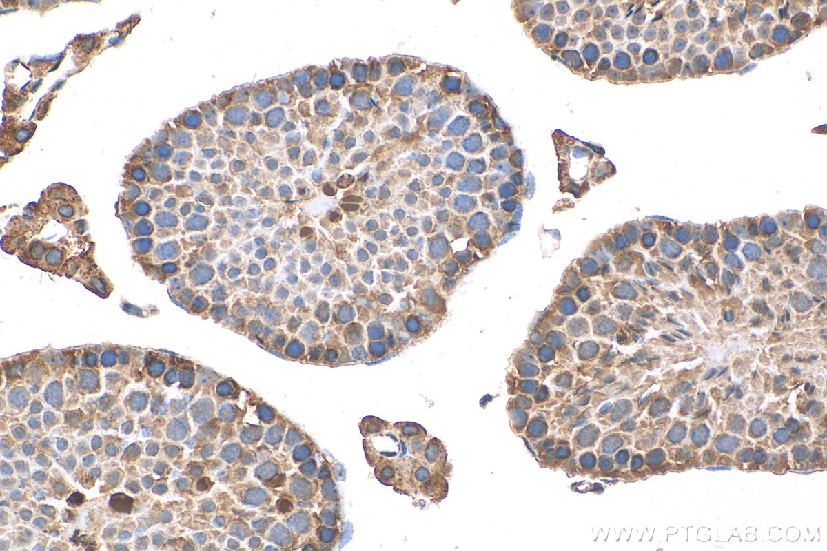 IHC staining of mouse testis using 25239-1-AP