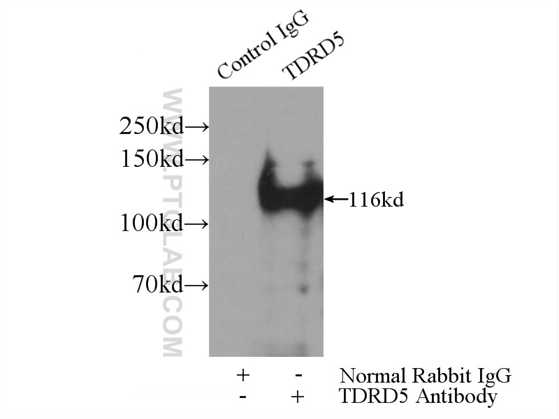 IP experiment of mouse testis using 25239-1-AP