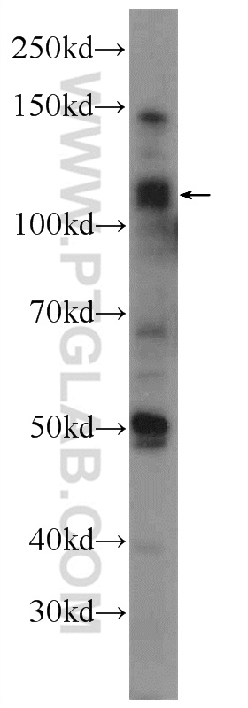 WB analysis of mouse testis using 25239-1-AP