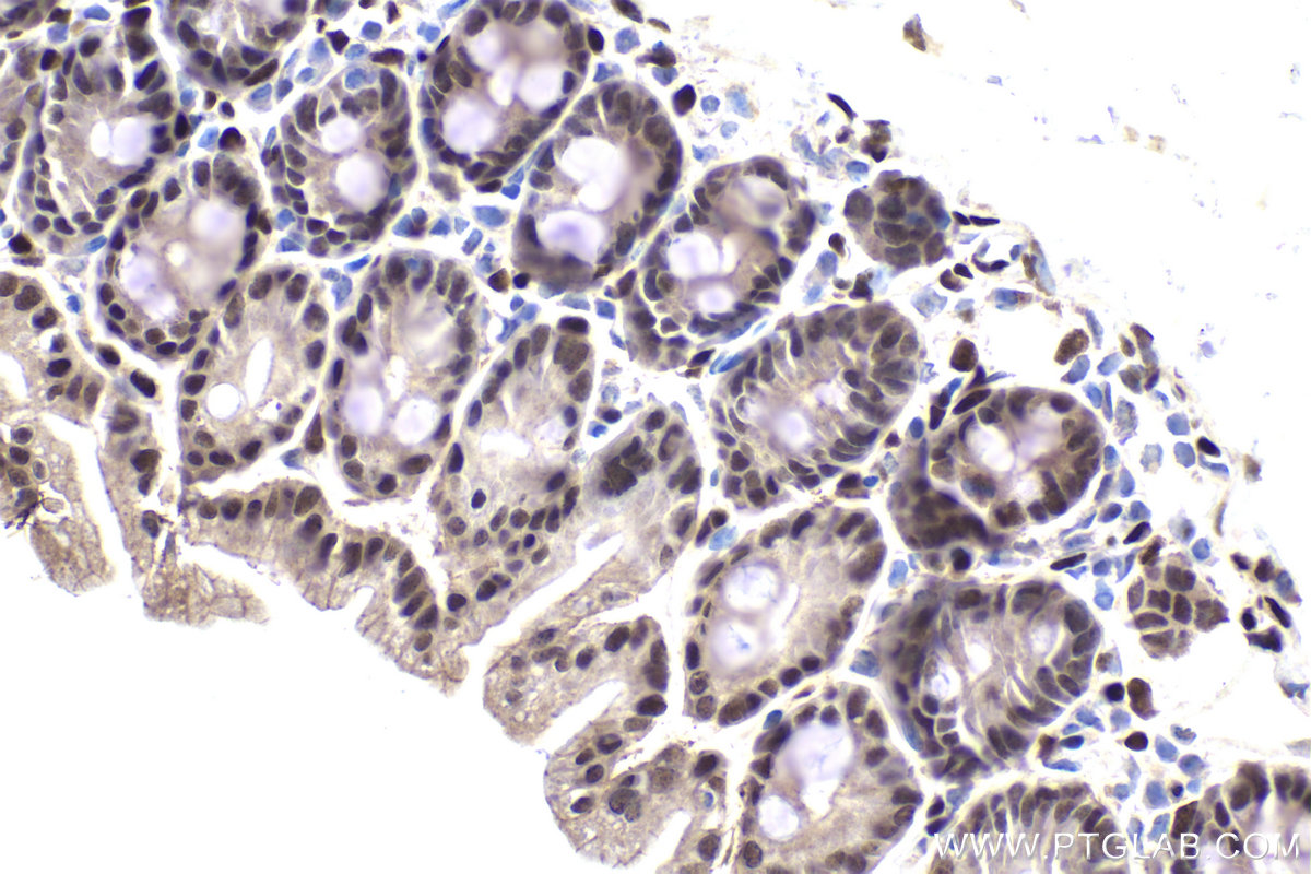 IHC staining of mouse small intestine using 13120-1-AP