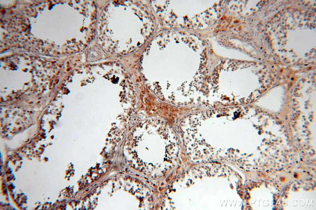 IHC staining of human testis using 18968-1-AP