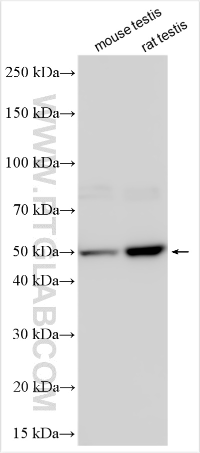 WB analysis using 13518-1-AP