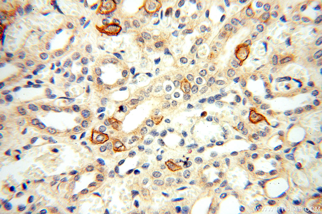 IHC staining of human kidney using 17058-1-AP