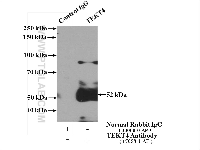 IP experiment of HeLa using 17058-1-AP