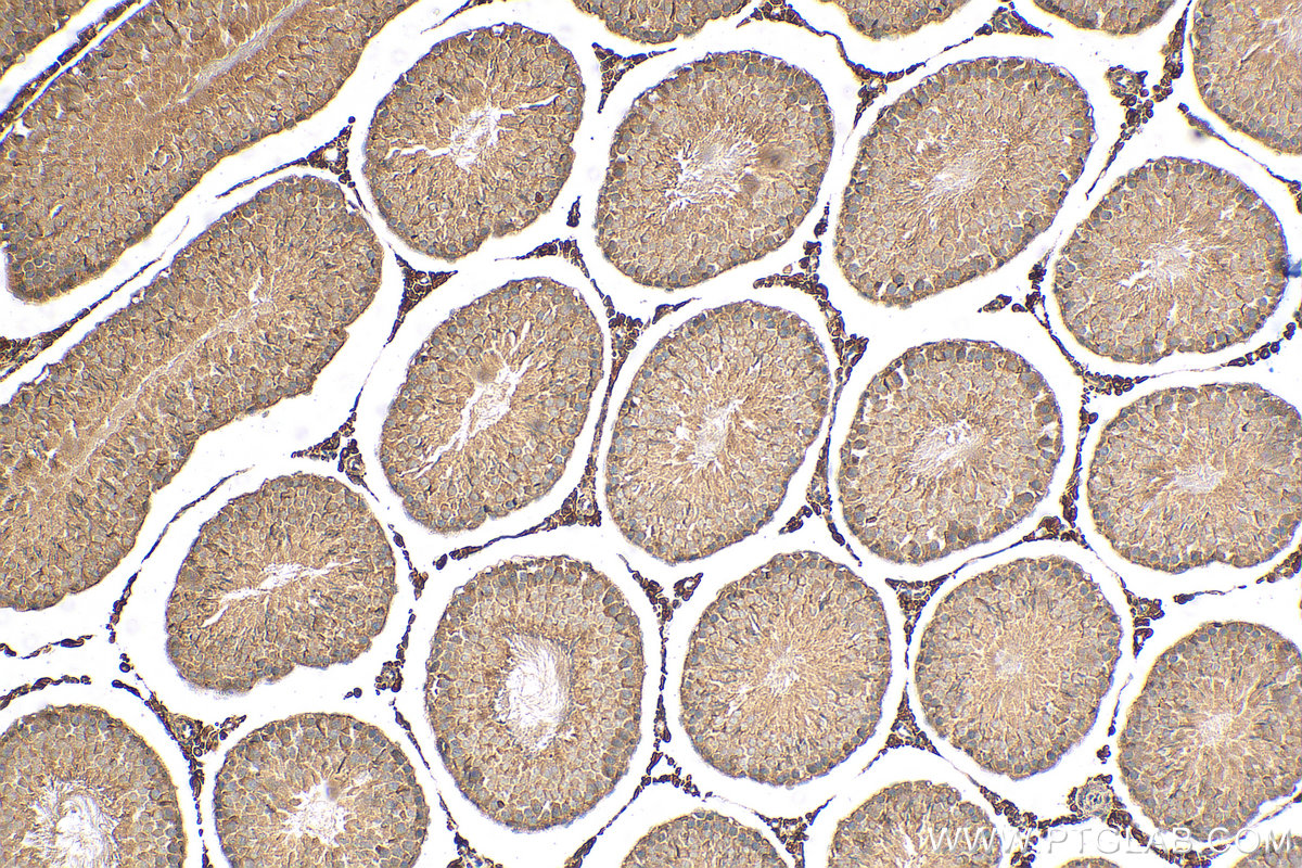 IHC staining of rat testis using 26108-1-AP