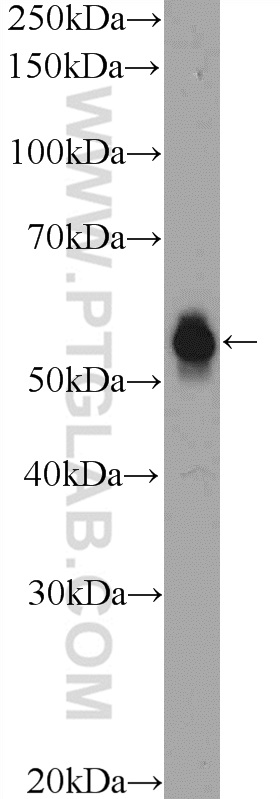 WB analysis of COLO 320 using 26108-1-AP