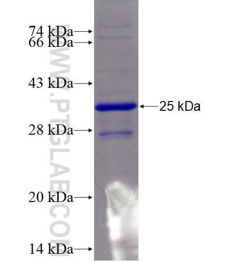 TEPP fusion protein Ag22871 SDS-PAGE