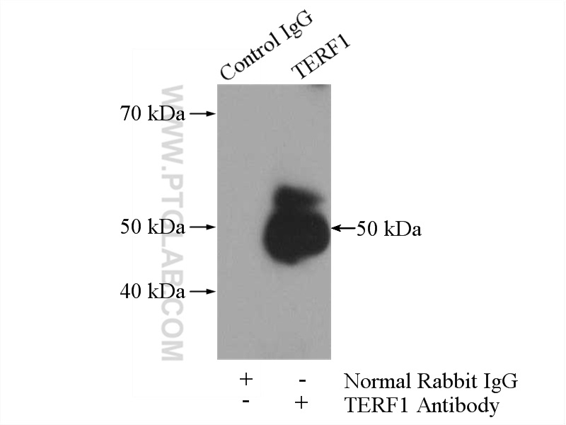 IP experiment of HEK-293 using 11899-1-AP