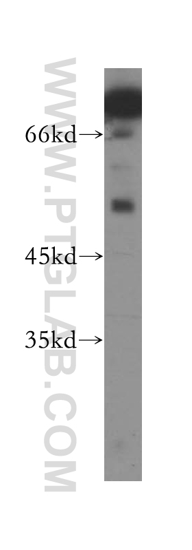 WB analysis of HEK-293 using 11899-1-AP