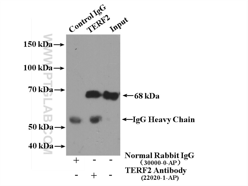 IP experiment of K-562 using 22020-1-AP